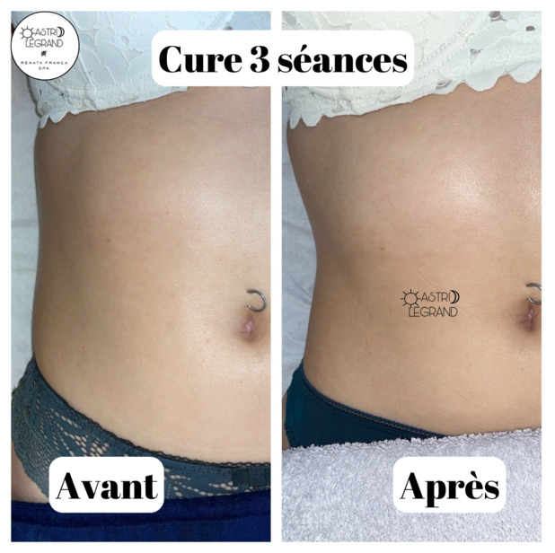 Astrid Legrand remodelage avant après renata franca massage drainant charleville