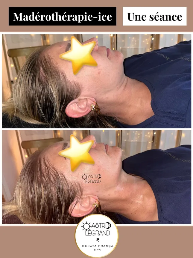 Astrid legrand madérothérapie avant après massage renata franca charleville reims 2