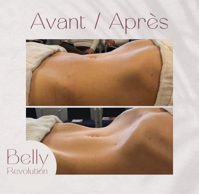 Massage Renata Franca minceur charleville Astrid drainage 1