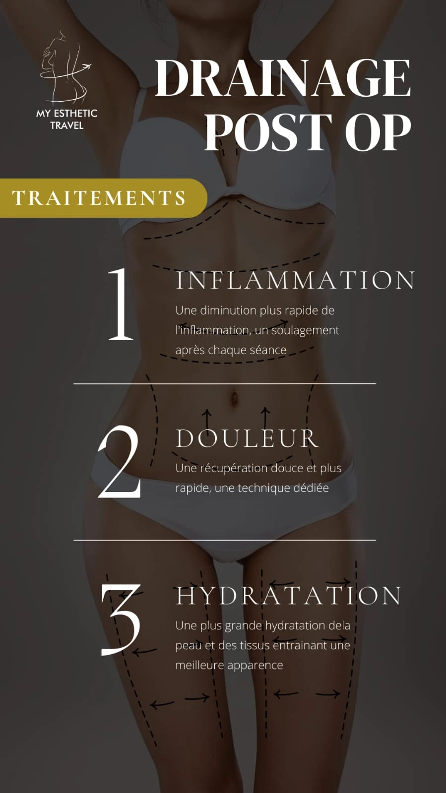 Astrid massages post opératoire drainant chirurgie lymphe ardennes charleville reims 1